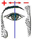 Beim Pseudostrabismus fhrt die Gesichtslinie nicht durch die Mitte der Hornhaut.