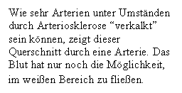 Text Box: Wie sehr Arterien unter Umstnden durch Arteriosklerose 